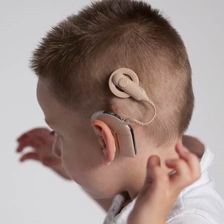 Слабослышащие степени. Слуховой аппарат тугоухость 4. Слуховой аппарат для детей. Слуховые аппараты для детей с 4 степенью тугоухости. Аппарат для глухих кохлеарная имплантация.