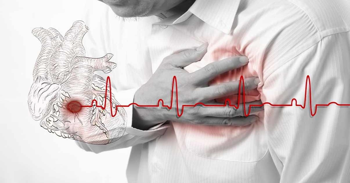 angina-chest-pain-tightness-symptoms-types-treatment